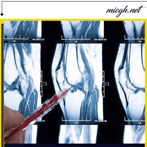 ام آر آی زانو - مرکز تصویر برداری دکتر قهرمانلو - micgh.net