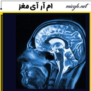 ام آر آی مغز - مرکز تصویر برداری دکتر قهرمانلو - micgh.net