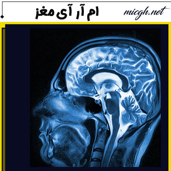 ام آر آی مغز - مرکز تصویر برداری دکتر قهرمانلو - micgh.net