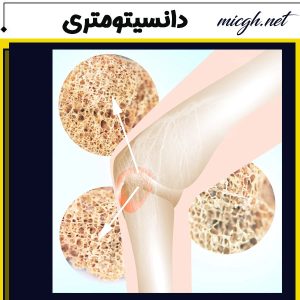 تست تراکم استخوان - مرکز تصویر برداری پزشکی دکتر مسعود قهرمانلو - micgh.net