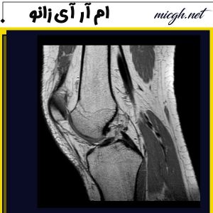 ام آر آی زانو - مرکز تصویر برداری پزشکی دکتر قهرمانلو - micgh.net