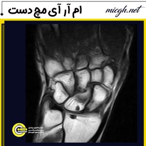ام آر آی مچ دست - مرکز تصویر برداری دکتر قهرمانلو - micgh.net