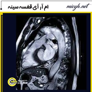 ام آر آی قفسه سینه - مرکز تصویر برداری دکتر قهرمانلو - micgh.net