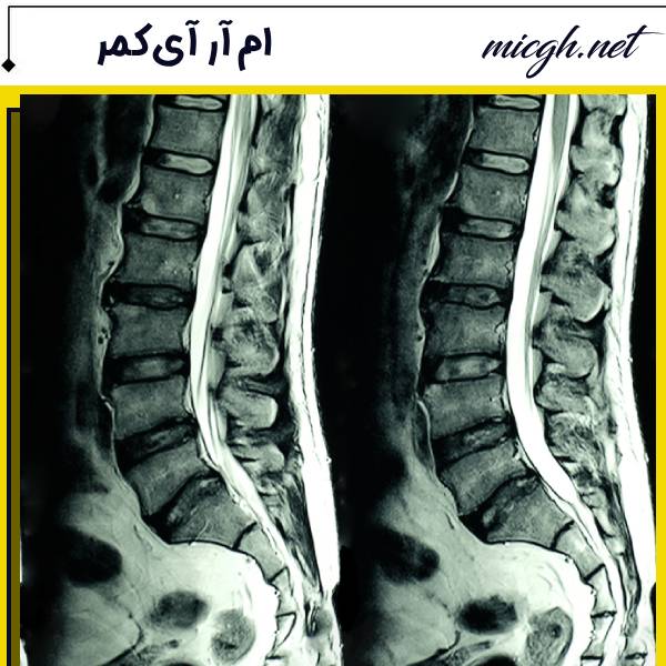 ام ار آی کمر