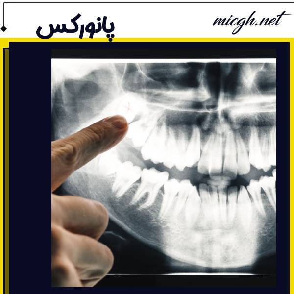 رادیوگرافی پانارومیک