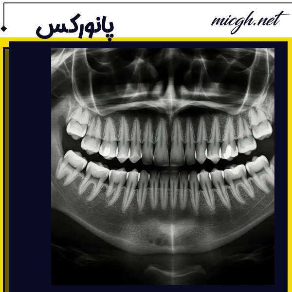 عکس پانورکس