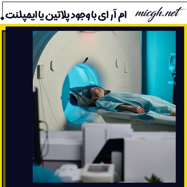 ام آر ای با وجود ایمپلنت دندان