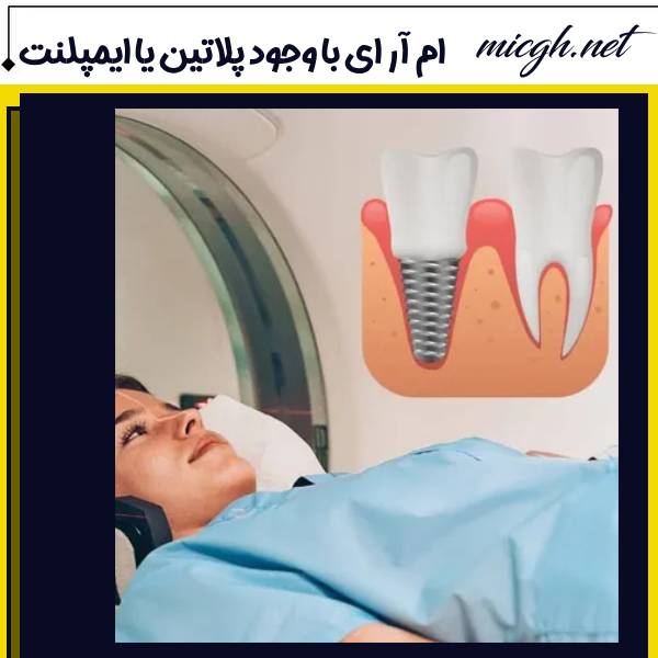 ام ار آی با وجود ایمپلنت 