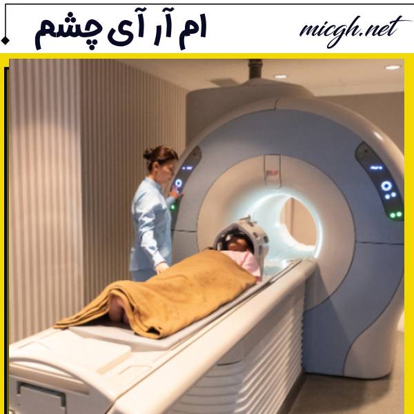 ام آر ای چشم