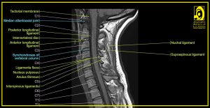 Neck AnatomyHkhj,ld 'vnk