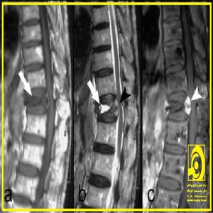 تصویربرداری MRI گردن
